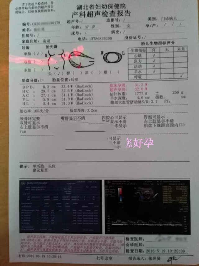 广州代妈