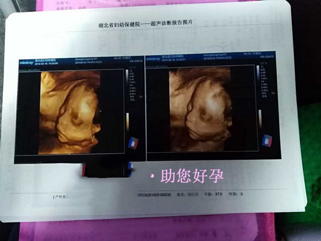 广州代妈